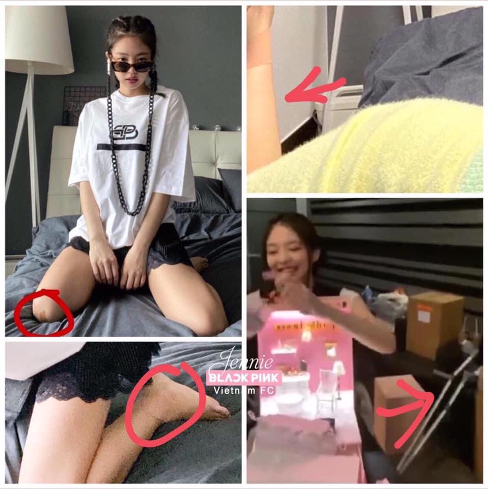 Hết Jennie đến Lisa chấn thương chân, fan đồn đoán vì vũ đạo của màn comeback quá nặng-4