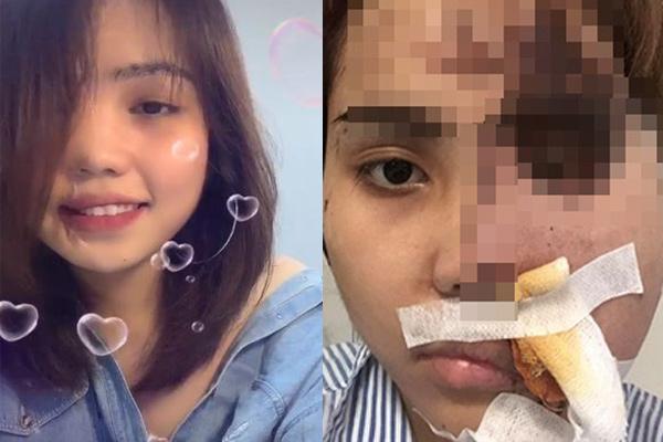 Cô gái bị tạt axit thắng ở Ai là triệu phú 8 năm trước giờ ra sao-12