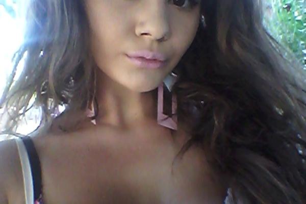 Choáng váng vì đôi môi dày nhất thế giới sau 20 lần tiêm filler-1