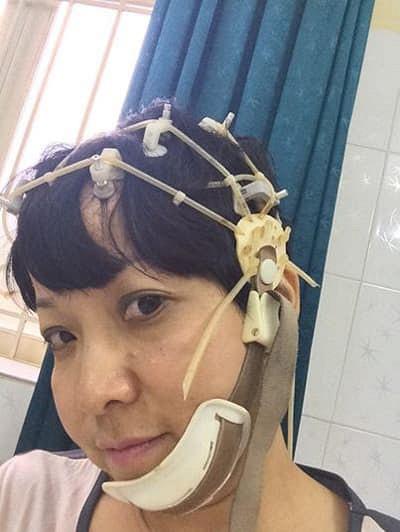 MC Thảo Vân quên cả hẹn với người thân do di chứng của bệnh teo thùy não trái-2