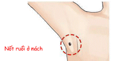 Cơ thể có 5 nốt ruồi này, khó khăn chỉ là tạm thời, phú quý sang giàu là mãi mãi-2