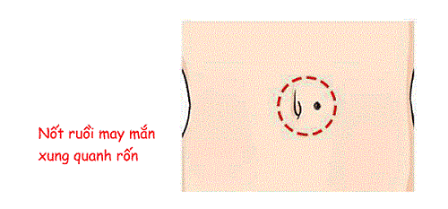 Cơ thể có 5 nốt ruồi này, khó khăn chỉ là tạm thời, phú quý sang giàu là mãi mãi-3