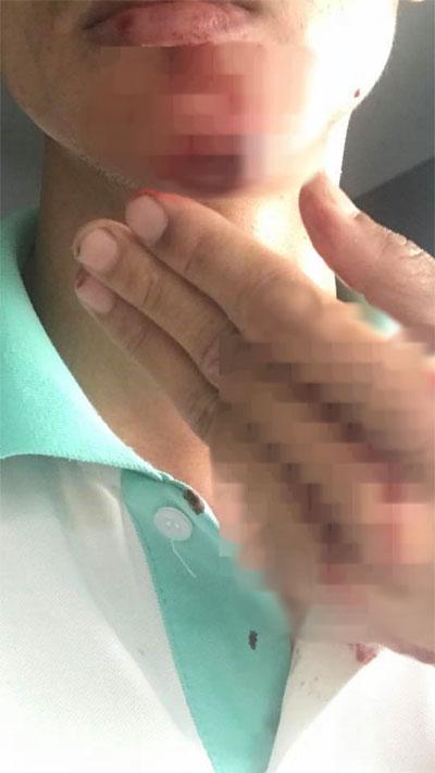 Thanh niên cầm gạch ném vỡ kính xe tải, tài xế bị rách cằm, còn đe dọa: Mày xuống đây, tao nhiều tiền án, tiền sự lắm rồi-3