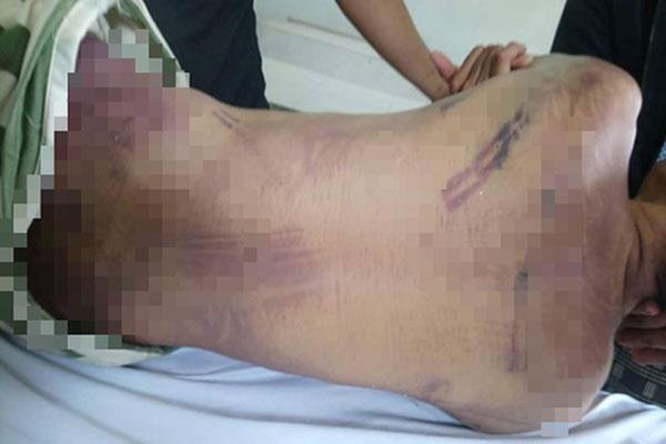 Công an Bà Rịa - Vũng Tàu giải thích vụ phạm nhân bị đánh chết trong trại giam với nhiều vết bầm tím-1