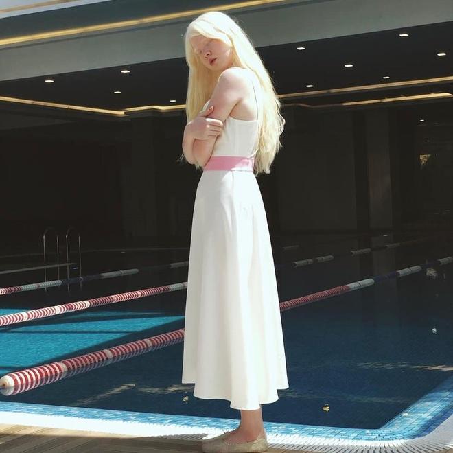 2 chị em bạch tạng ở Kazakhstan nổi tiếng nhờ vẻ đẹp khác lạ-7