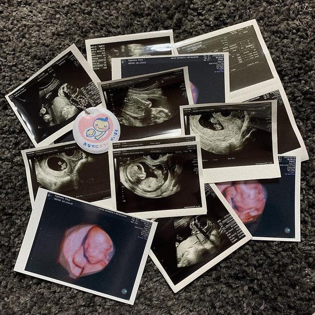 Cặp đôi hotboy - hotgirl gây shock khi thông báo lên chức bố mẹ ở tuổi 16-4