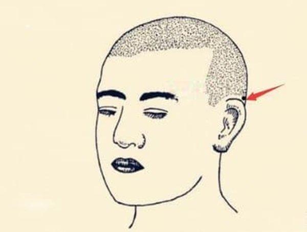 Nốt ruồi tài lộc là gì? Ở những vị trí nào trên cơ thể của bạn có nốt ruồi tài lộc?-2