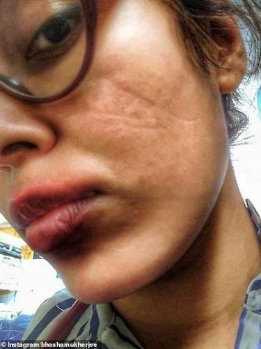 Mặt hoa hậu Anh bị tổn thương vì đeo khẩu trang-2