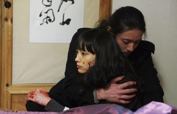 Lee Min Ho và loạt sao bị tai nạn, mảnh kính găm vào cổ khi quay phim-8