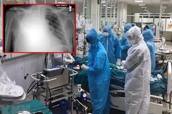 Truy tìm thanh niên ở An Giang trốn cách ly sau khi về từ Campuchia, chưa kịp lấy mẫu xét nghiệm-2