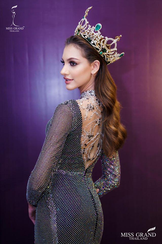 Hoa hậu Hòa bình thừa nhận thẩm mỹ, hình ảnh đập mặt xây lại gây ám ảnh-3