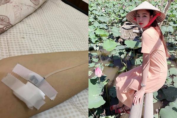 Kỳ Hân khoe bụng bầu vượt mặt, dung mạo xấu như chưa từng được xấu-5