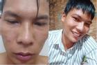 Được bao tiền thẩm mỹ, 'YouTuber nghèo nhất Việt Nam' quyết không dao kéo để bảo tồn nhan sắc