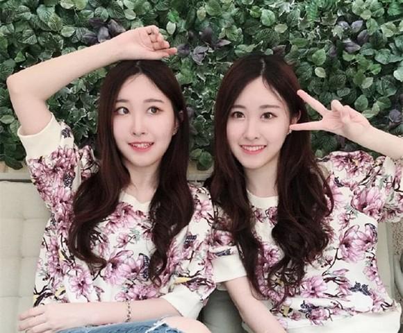 Cặp song sinh từng gây sốt vì xinh đẹp nhất châu Á, sau 17 năm giờ ra sao?-2