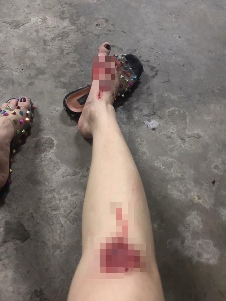 Người mẫu Cao Thùy Linh kể chuyện bị sàm sỡ vùng nhạy cảm khi đang chờ đèn đỏ-3