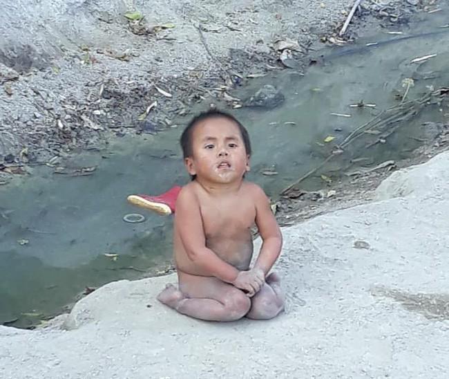 Ngỡ ngàng trước ngoại hình em bé Mường Lát liệt 2 chân sau gần 3 năm được nhận nuôi-1