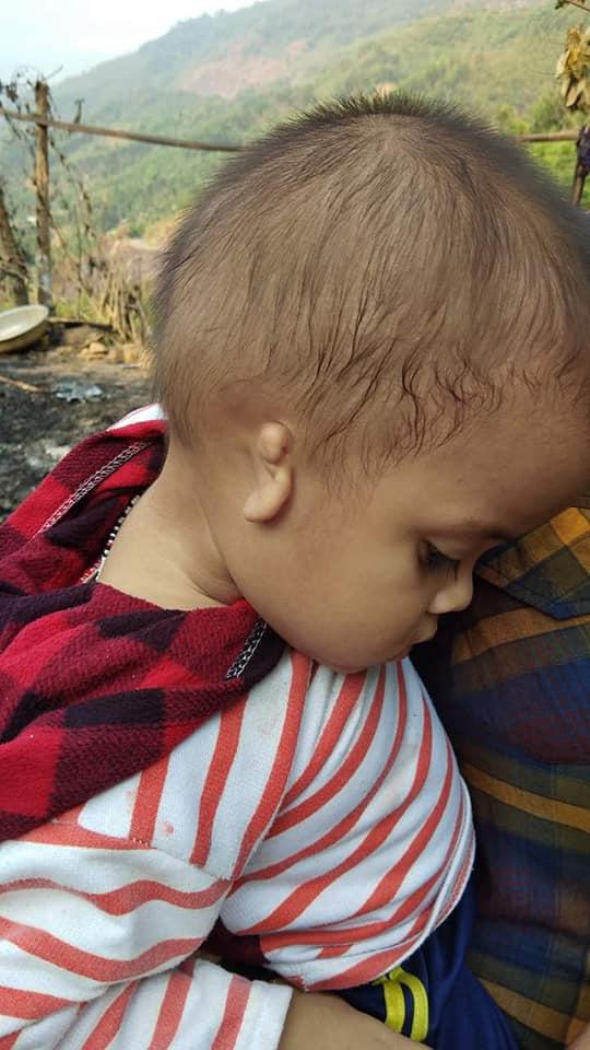 Hy hữu chuyện cháu bé 2 tuổi ở Quảng Nam gặp nạn trên trời rơi xuống-5