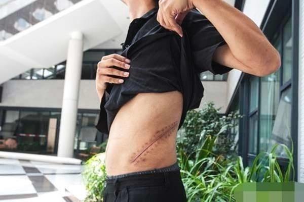 Cuộc sống bi thảm của nam sinh bán thận mua iPhone-4