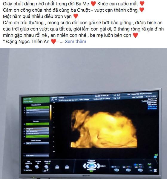 Kế hoạch sinh con của ông bố đầu tiên ở Việt Nam bị thay đổi bất ngờ vào phút chót-2