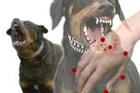Nghệ An: Chó phát bệnh dại cắn liên tiếp 2 cháu nhỏ