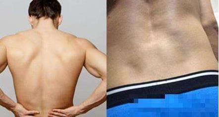 Hai điểm lõm trên eo là gì? Tại sao một số người có và một số thì không?-3