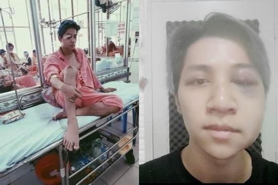 Trưởng nhóm The Wings chấn thương não, liệt nửa mặt sau tai nạn