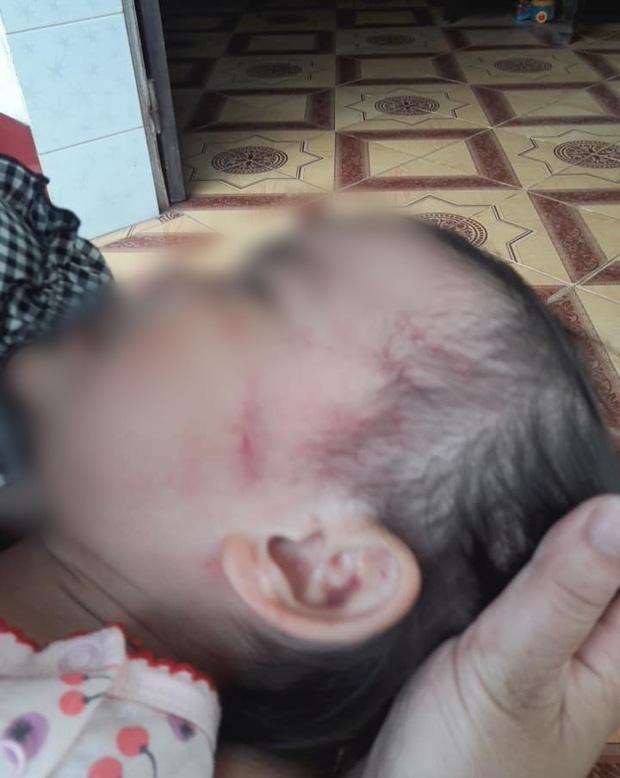 Bắc Giang: Nghi vấn cơ sở mầm non tư thục bạo hành dã man bé gái hơn 2 tuổi khi mới nhập học 3 ngày-2