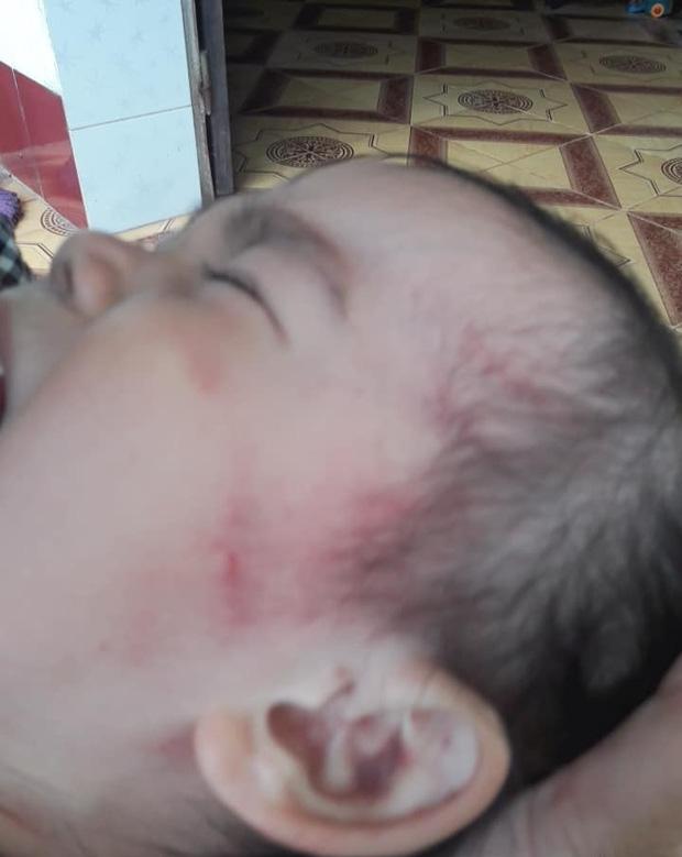 Bắc Giang: Nghi vấn cơ sở mầm non tư thục bạo hành dã man bé gái hơn 2 tuổi khi mới nhập học 3 ngày-3