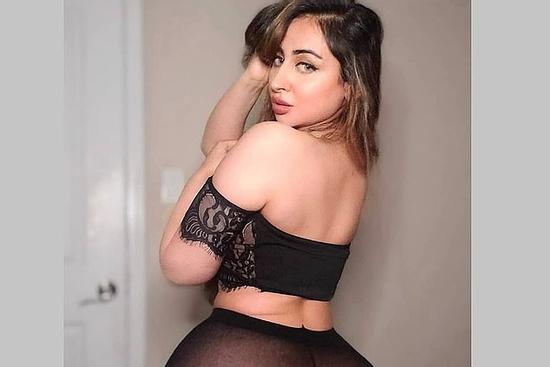 Nữ người mẫu không thể ngồi 6 tháng vì phẫu thuật vòng 3 'siêu khủng'