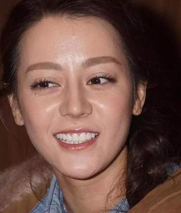 Sốc với ảnh mặt bóng dầu, đường nét méo mó gây thất vọng của Địch Lệ Nhiệt Ba, càng choáng hơn vì sự thật đằng sau-3