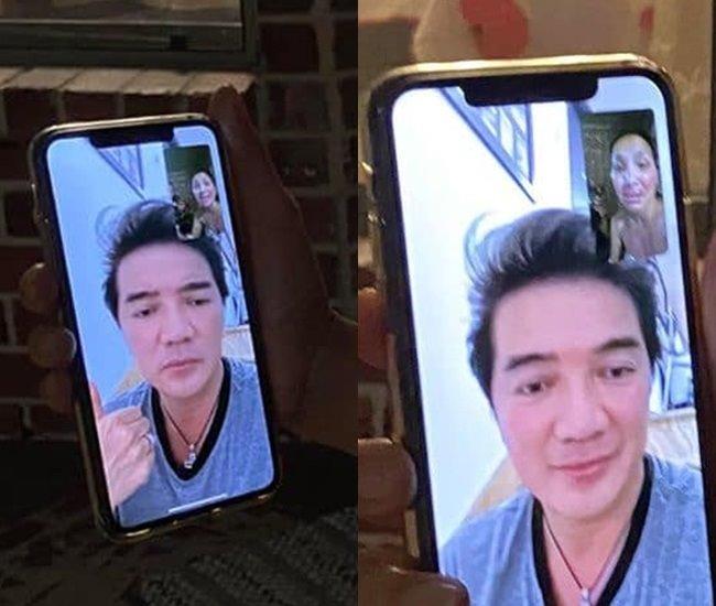 Gương mặt bỏng nặng của Hồng Ngọc lộ rõ qua màn hình facetime khiến ai nhìn cũng xót-2