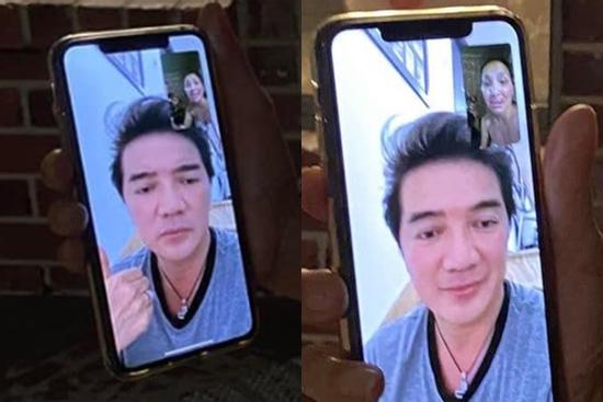 Gương mặt bỏng nặng của Hồng Ngọc lộ rõ qua màn hình facetime khiến ai nhìn cũng xót