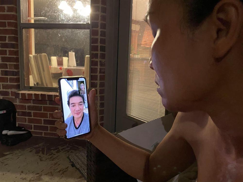 Gương mặt bỏng nặng của Hồng Ngọc lộ rõ qua màn hình facetime khiến ai nhìn cũng xót-3