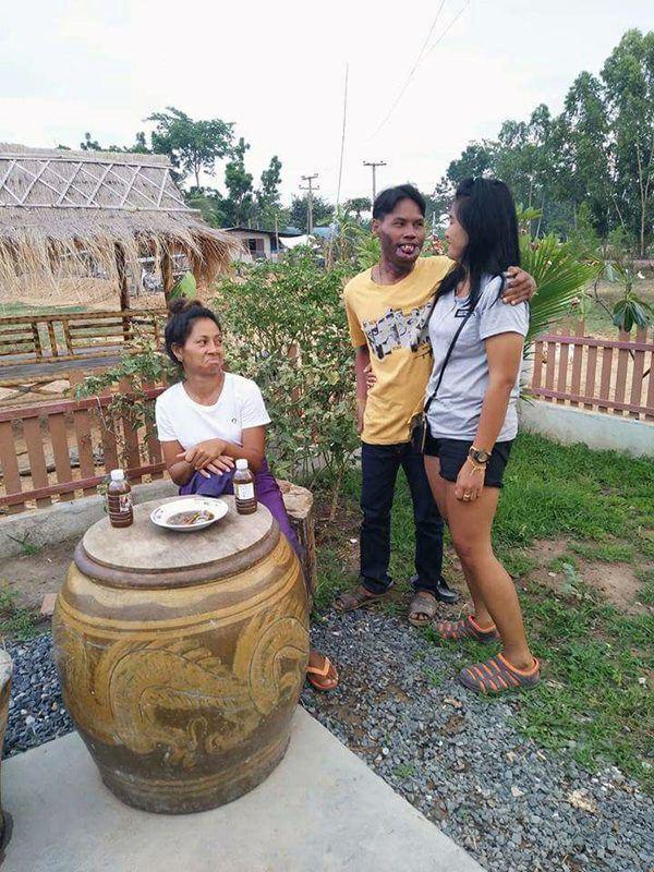 Bất ngờ cuộc sống hiện tại của cô gái xinh đẹp kết hôn người đàn ông mang gương mặt quỷ-2