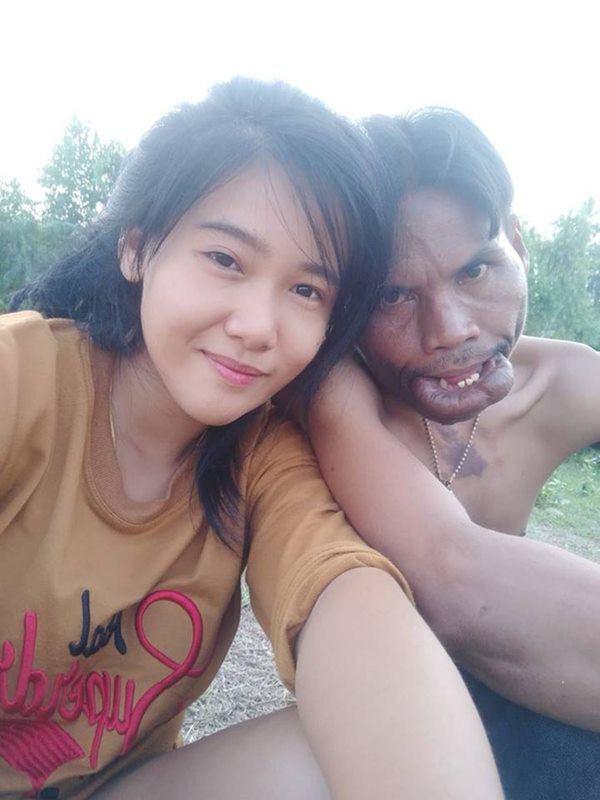 Bất ngờ cuộc sống hiện tại của cô gái xinh đẹp kết hôn người đàn ông mang gương mặt quỷ-1