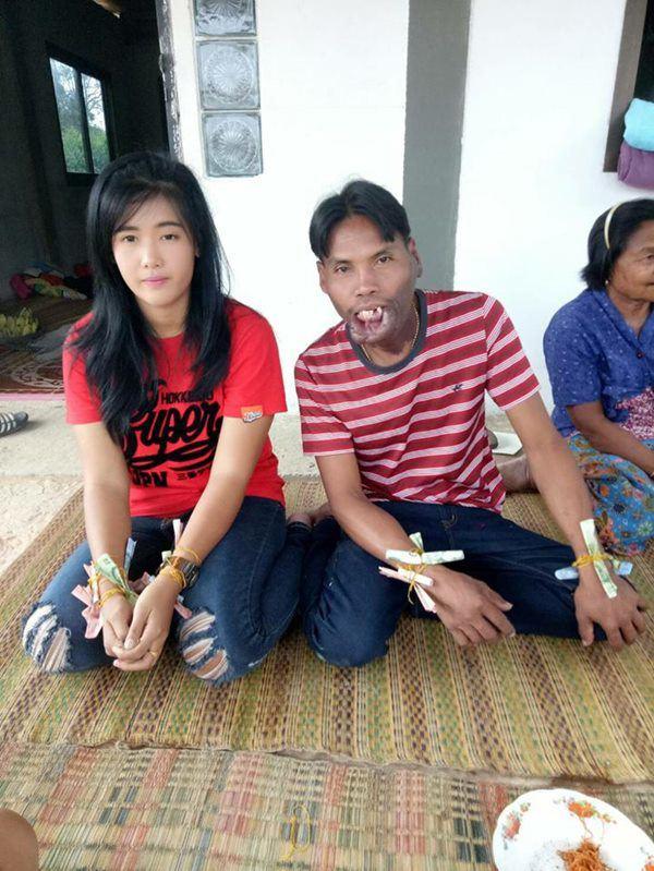 Bất ngờ cuộc sống hiện tại của cô gái xinh đẹp kết hôn người đàn ông mang gương mặt quỷ-3