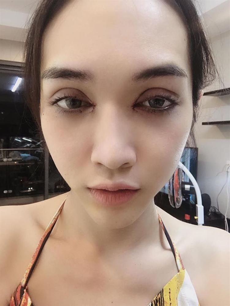 5 năm dao kéo từng chút một trên cơ thể: Chàng trai mãn nguyện hóa mỹ nữ, sửa sai cho số phận-5