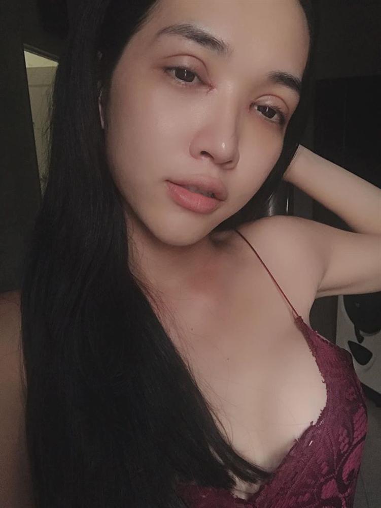 5 năm dao kéo từng chút một trên cơ thể: Chàng trai mãn nguyện hóa mỹ nữ, sửa sai cho số phận-6