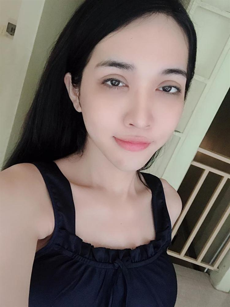 5 năm dao kéo từng chút một trên cơ thể: Chàng trai mãn nguyện hóa mỹ nữ, sửa sai cho số phận-7