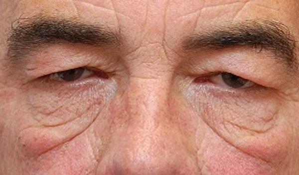 Tướng mặt của những người tuyệt đối không nên kết giao-2