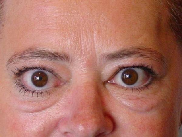 Tướng mặt của những người tuyệt đối không nên kết giao-3