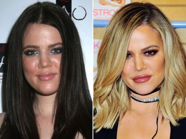 Khloé Kardashian bị chế nhạo vì chỉnh ảnh đến khó nhận ra-2