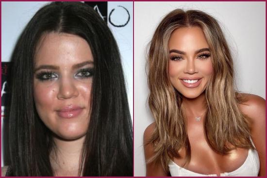 Khloé Kardashian bị chế nhạo vì chỉnh ảnh đến khó nhận ra