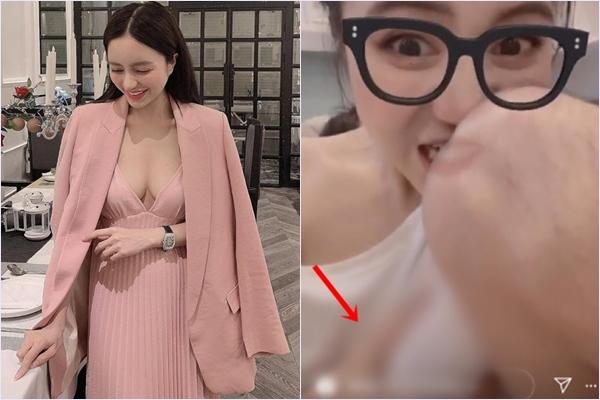 Hot girl Trang Anna bổ sung ca phẫu thuật hạ gò má vào bộ sưu tập đập mặt xây lại-6