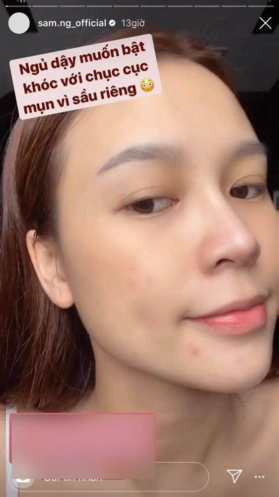 SAO MAKE OVER: Sam lộ mặt mụn - Ji Yeon T-ara trang điểm hai hàng lông mày khó hiểu-2