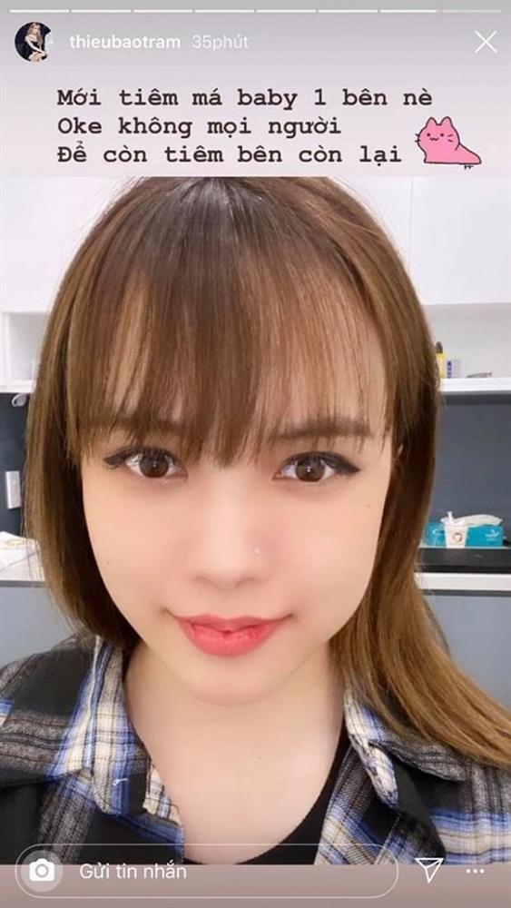 Thiều Bảo Trâm bất ngờ đăng ảnh mặt sưng vù, thừa nhận tiêm má?-1