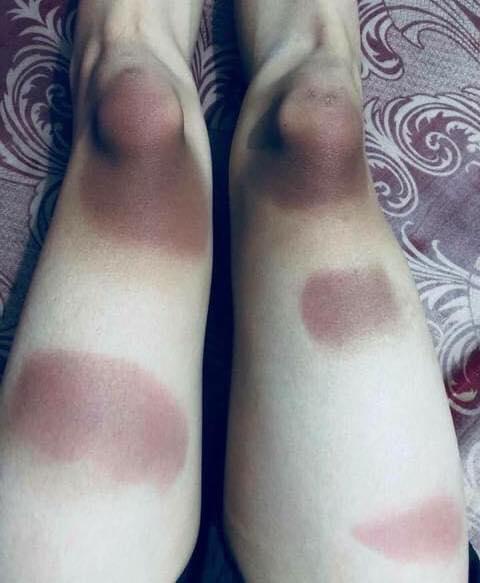 Những pha cháy nắng nhìn không biết nên khóc hay nên cười-5