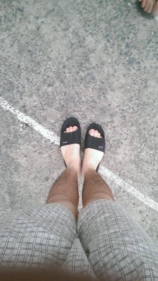 Những pha cháy nắng nhìn không biết nên khóc hay nên cười-7