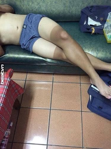 Những pha cháy nắng nhìn không biết nên khóc hay nên cười-4