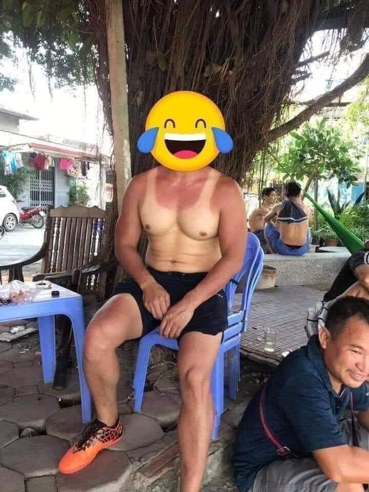 Những pha cháy nắng nhìn không biết nên khóc hay nên cười-1